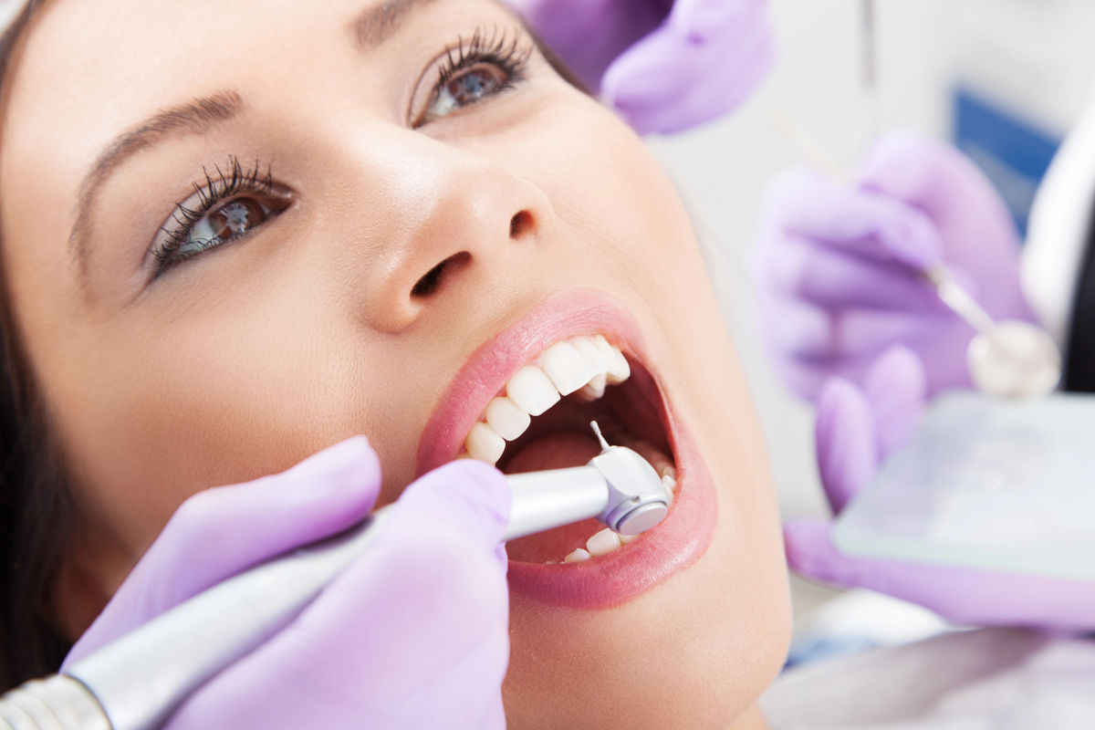 Le stripping Invisalign : pourquoi et comment ? Le guide