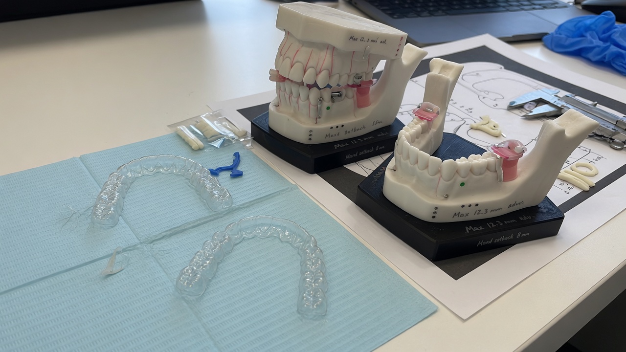 Consultation avec un modèle 3D pour évaluer un décalage de mâchoires